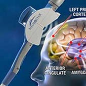 What is TMS?